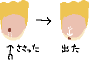 指はすごい_a0003166_1553889.gif
